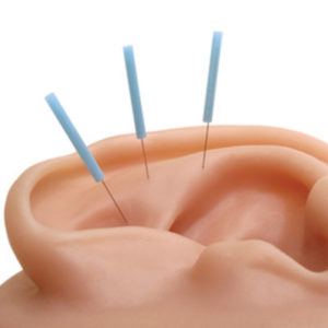 Der gesamte Körper spiegelt sich in Form von Reflexzonen an den Ohren wieder. Durch die Akupunktur bestimmter Ohr-Punkte können alle Organ-Systeme erreicht werden.